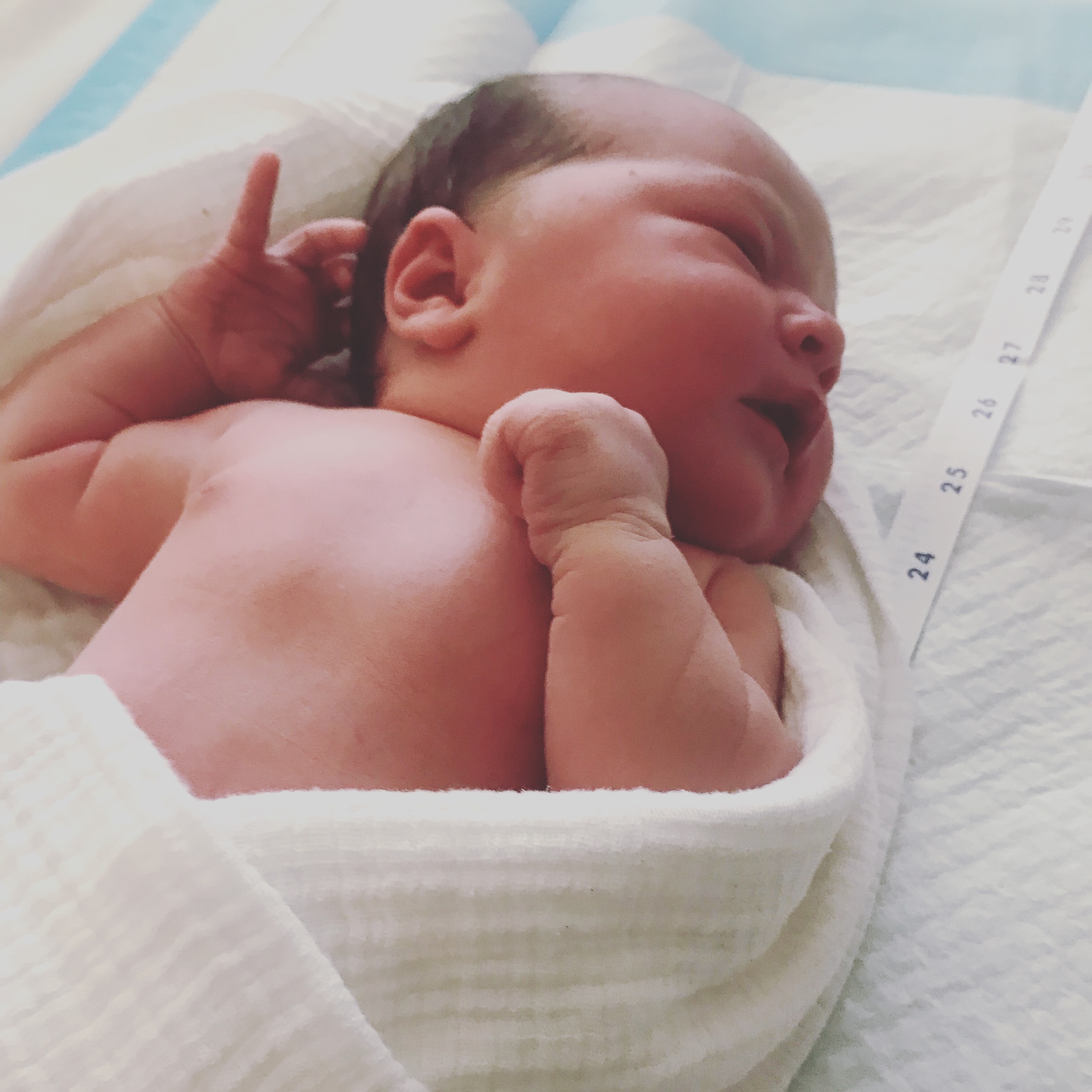 The Epidural Epidemic